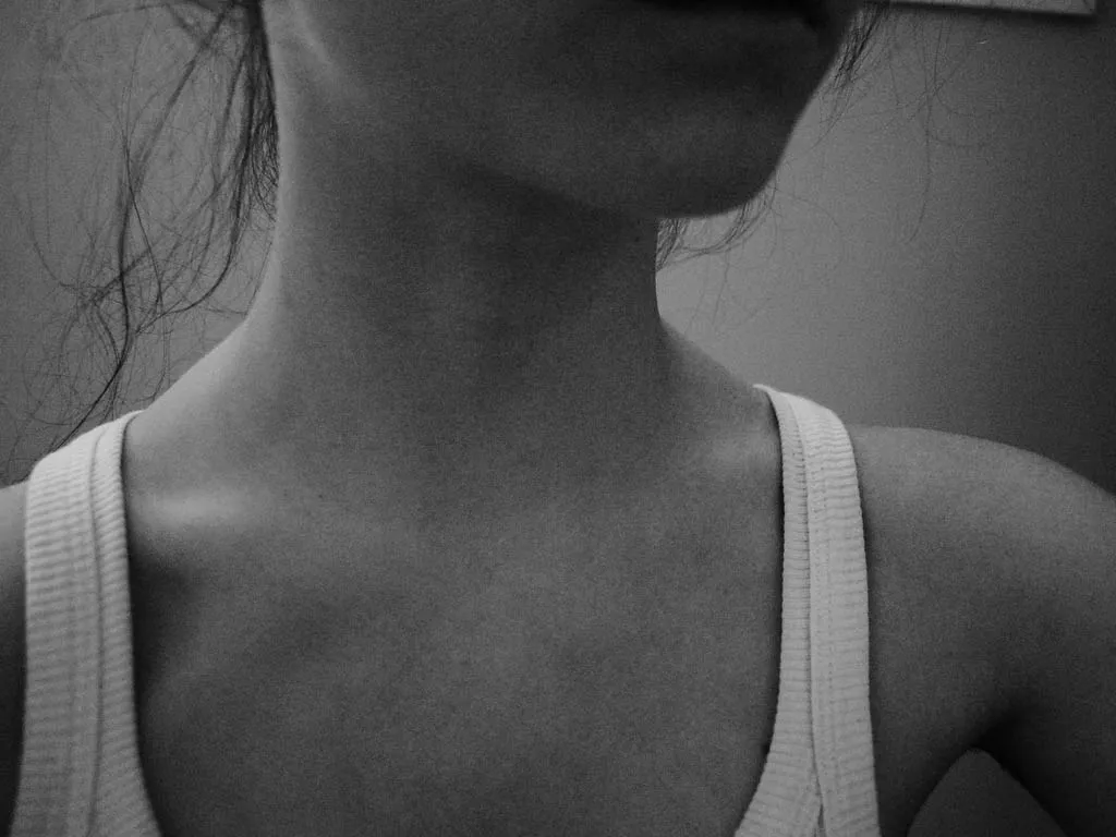 Anorexia nervoasă