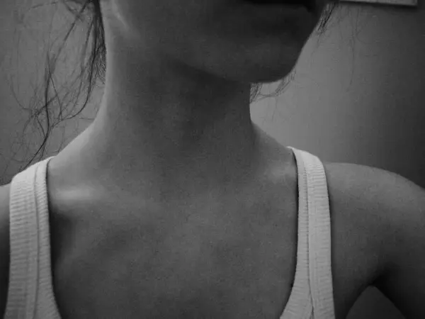 Anorexia nervoasă